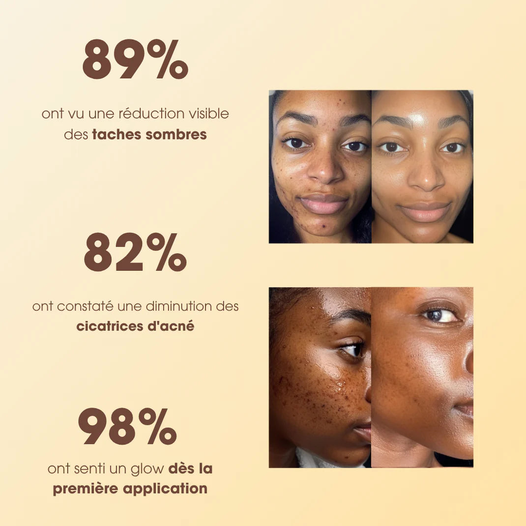 Savon Anti-Taches au Curcuma et à l’Acide Kojique